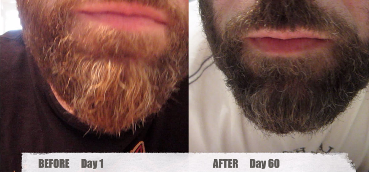 60 Day Update! Life Vitality Gray Hair Rescind from DR Vitamin Solutions